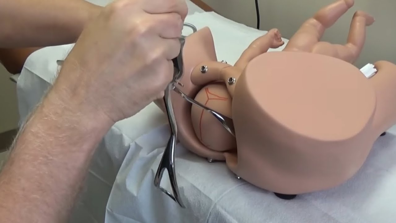 Ekstraksi Forceps - Obgyn