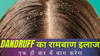 डैंड्रफ का घरेलू इलाज | How to get rid of dandruff | Dandruff treatment at home