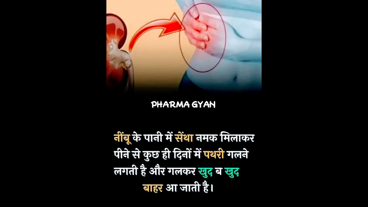 kidney stone, pathri nikalne ka upaye 