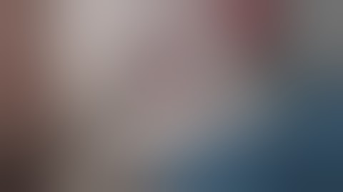 Minimally-Invasive Posterior Socket Preservation: Case 2