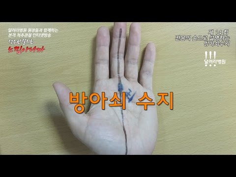 손가락퇴행성관절염