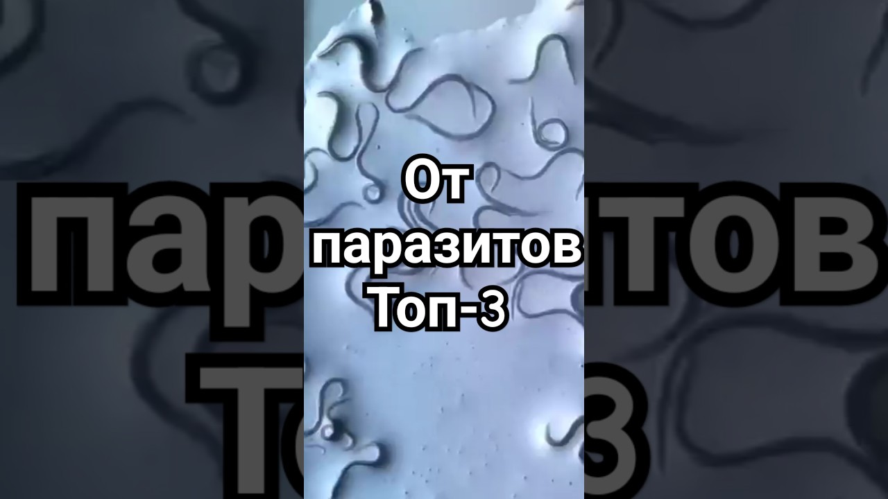 ТОП-3 масла холодного отжима от паразитов: тыквенное, черного тмина и льняное сыродавленное масло