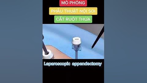 Phẫu thuật cắt ruột thừa nội soi ( mô phỏng 2D)