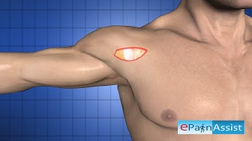 Shoulder Arthroscopy Procedure