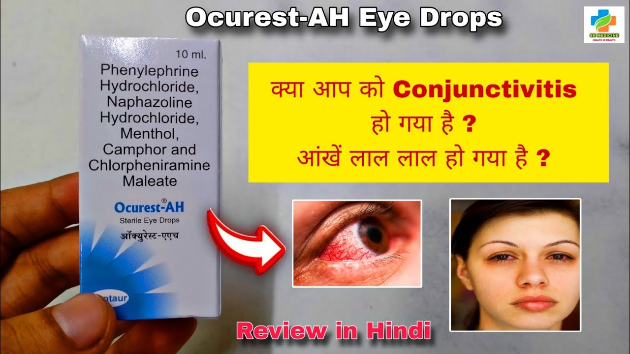 OcurestAH Eye Drops Use in Hindi Conjuctivitis Eye Flu Viral