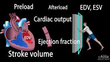 Cardiac Output, Stroke volume, EDV, ESV, Ejection Fraction