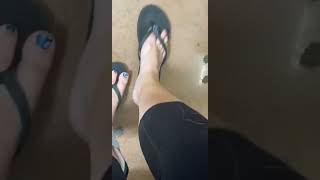 Friend In Store Sandals And Aircast