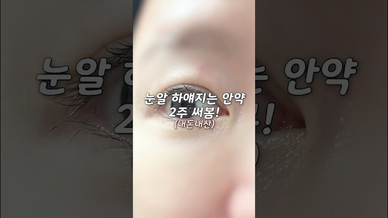 눈알 하얘지는 안약 내돈내산 14일 써본 후기...과연?😇 #독일직구안약 #눈알하얘지는법 #shorts
