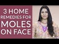 3 Quick Home Remedies To Get Rid Of MOLES ON FACE