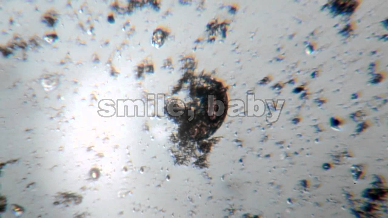 microscope Rotaria Rotifer 05 - YouTube