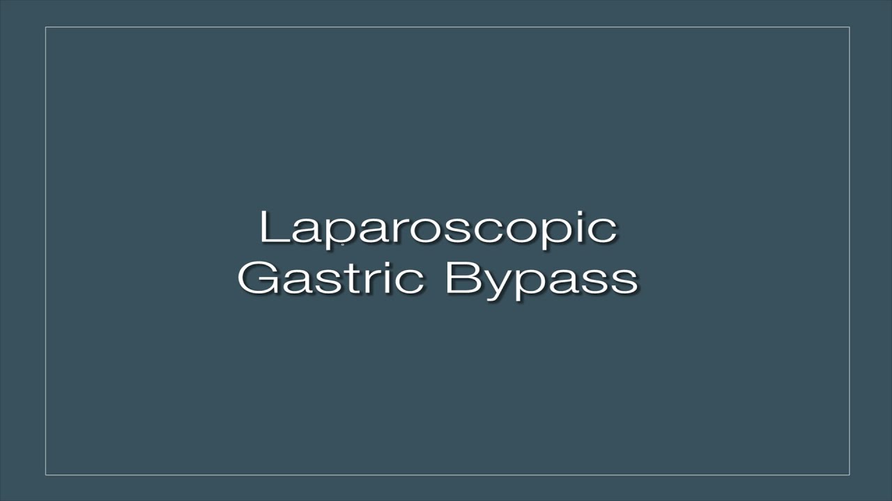 Laparoscopic Gastric Bypass