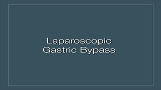 Laparoscopic Gastric Bypass