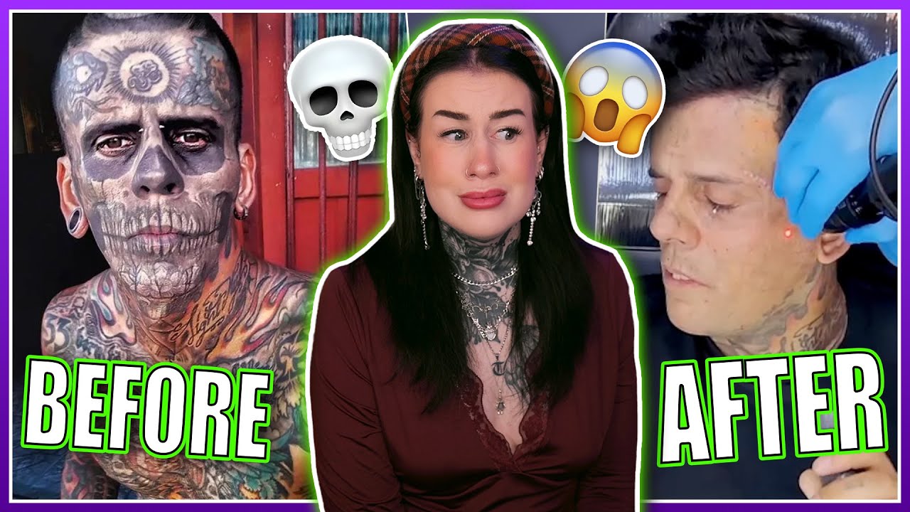 EXTREME Tattoo Removal Transformations