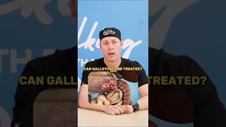 How To Get Rid of Gallstones? #shorts
You might think you can get rid of gallstones naturally — but what actually works, and what’s a waste of time?
đź“© Contact us: talkingwithdocs@gmail.com
In this episode, we break down every major gallstone treatment and rank them based on how well they actually work. From home remedies like apple cider vinegar to modern surgical options, we cut through the myths and show you what truly helps — and what doesn’t.
We cover:
Why “natural remedies” like ACV, lemon juice, and olive oil barely work (0–1/10) 🍋
Why lithotripsy is rarely used today and scores low in effectiveness ⚡
The truth about direct dissolution treatments — invasive with poor results 🧪
How Ursodeoxycholic acid works, who it’s for, and why it only gets a moderate score 💊
Why results from non-surgical options are often slow, inconsistent, and temporary ⏳
The gold standard treatment: Laparoscopic cholecystectomy — and why it ranks 9.5/10 🏥
If you’re dealing with gallstones — or trying to avoid surgery — this episode gives you a clear, doctor-backed breakdown of your real options and what to expect from each one.
🎧 Listen on Your Favourite Platforms:
Spotify: https://open.spotify.com/show/3OFxEji...
Apple Podcast: https://podcasts.apple.com/ca/podcast...
YouTube Music: • TWD Podcast
đź‘• Shop Our MERCH: https://www.spreadshirt.ca/shop/user/...
❤️ Support Oakville Hospital: https://donate.oakvillehospitalfounda...
📱 Follow Us:
TikTok: / talkingwithdocs
Instagram: https://www.instagram.com/talkingwith...
Facebook: https://www.facebook.com/profile.php?...
🛑 DISCLAIMER:
This content is for educational purposes only and not a substitute for professional medical advice. Always consult your doctor before making any changes to your health regimen. Full disclaimer at talkingwithdocs.com
#gallstones #gallbladder #gallstonetreatment #healthmyths #medicalfacts #surgery #digestivehealth #ursodeoxycholicacid #laparoscopicsurgery #talkingwithdocs #healthtips #doctorsexplain How To Get Rid of Gallstones? #shorts