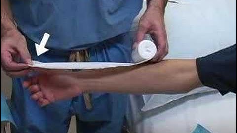 Thumb Spica Splint (sample) - www.proceduresconsult.com