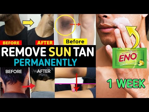 Remove Sun Tan From Body At Home | Lighten DARK Knees, Neck And Elbows Quickly And NATURALLY At Home