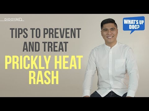 Video: Paano Mapupuksa Ang Prickly Heat Sa Isang Bagong Panganak