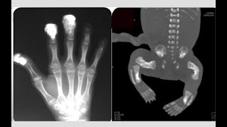 Radiology spotters #1#msk#muscloskeletal#15 cases in 15 minutes #mri#ct#xray#ultrasound#radiopedia screenshot 1