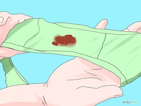 Como quitar manchas de sangre del colchon