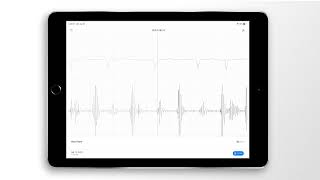 Atrial Fibrillation Combined Heart Sound, PCG & ECG Example - EkoCLINIC App