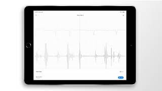 Atrial Fibrillation Combined Heart Sound, PCG & ECG Example - EkoCLINIC App Resimi