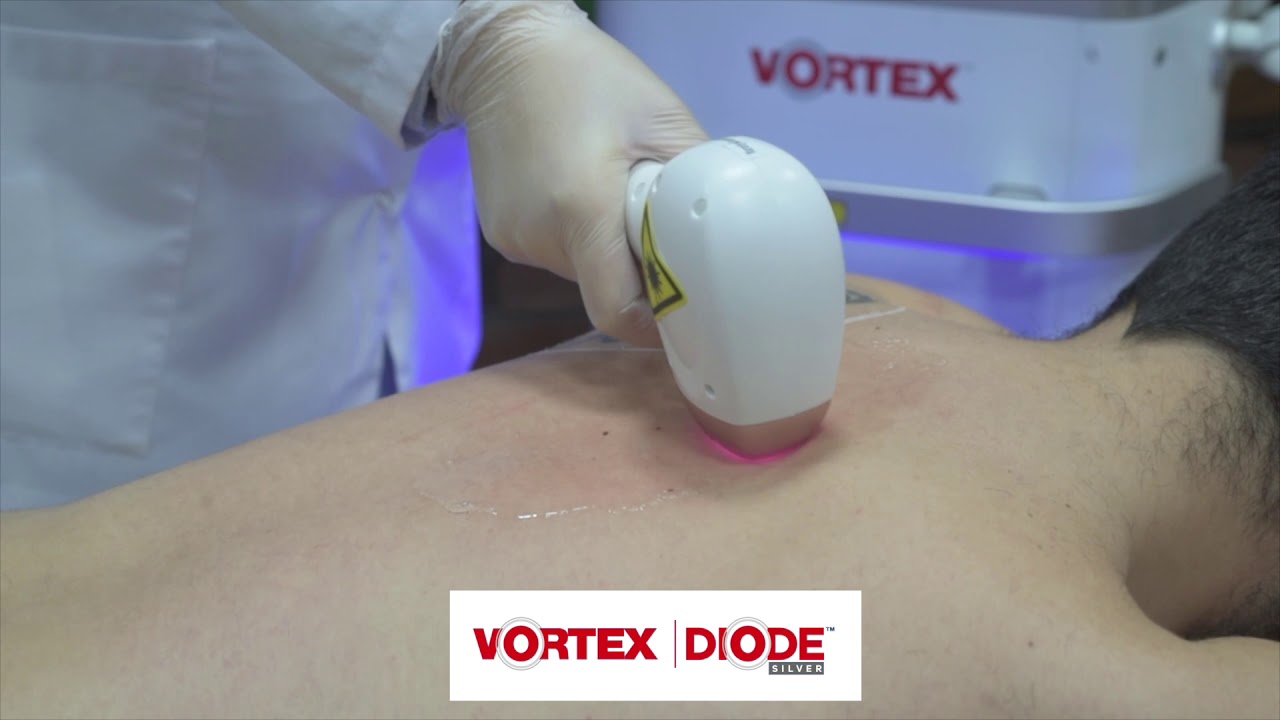 Vortex Diode Direction VORTEX DIODE - YouTube