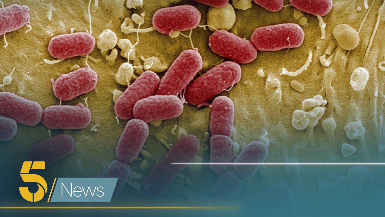 E coli outbreak as more than 100 cases reported in UK | 5 News - YouTube