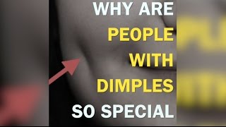 Why Are People With Dimples So Special