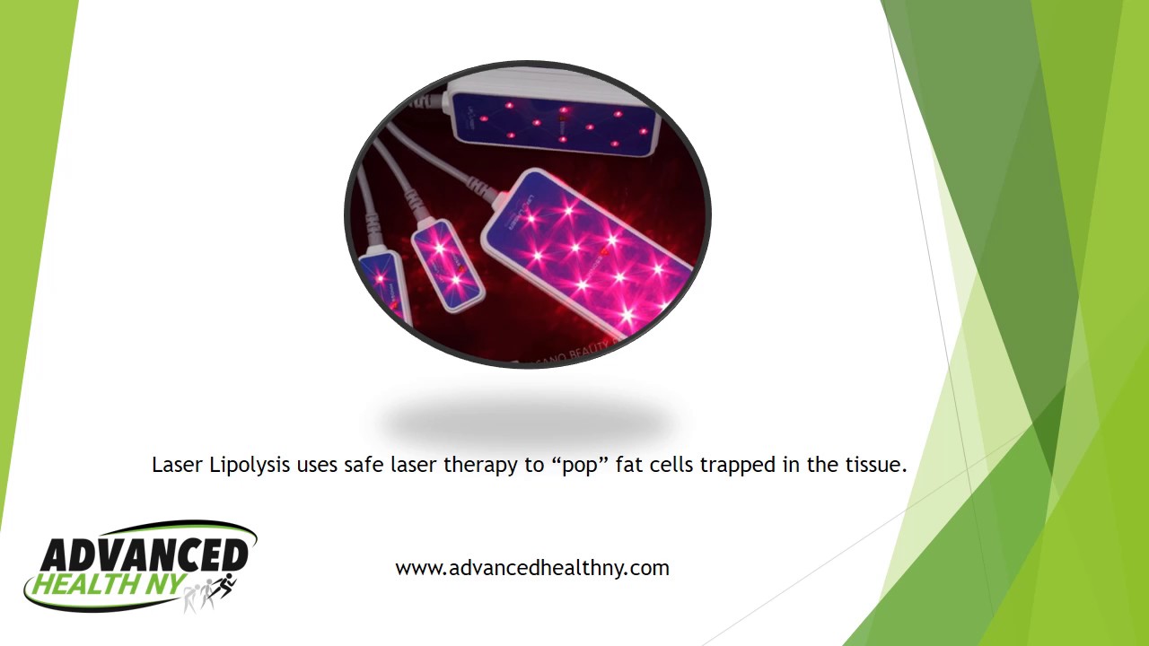 Laser Lipo YouTube