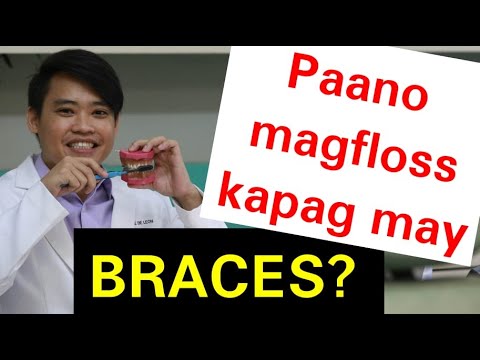 Video: 4 na paraan upang mag-floss sa mga brace