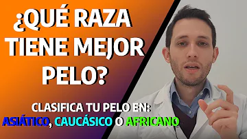 ¿Qué raza es más propensa a la calvicie?