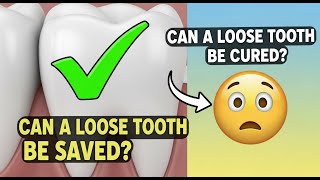 ✅ Can a loose tooth be saved? / Can a loose tooth be cured? 👈😳