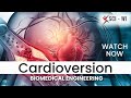 Cardioversion  sciwi biomedical engineering