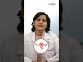 What are the symptoms of Fibroids during Pregnancy | Dr. Charu Lata Bansal | Cocoon Hospital