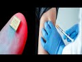 Myth and Fact | COVID19 Vaccination