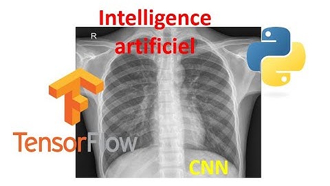 🔍 AI in Medical Imaging: Pneumonia Detection Revolution! 🩺🤖