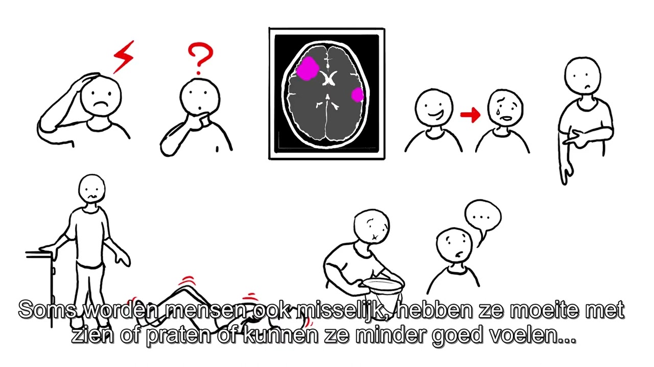 Uitzaaiingen in de hersenen bij longkanker