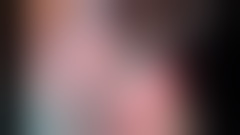 Mastering the art of taking the Superior Rectus Bridle suture