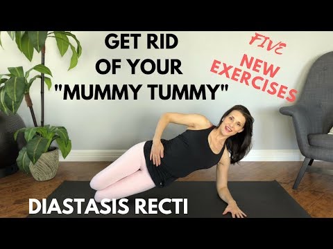 Video: Miks põhjustab diastasis recti puhitus?