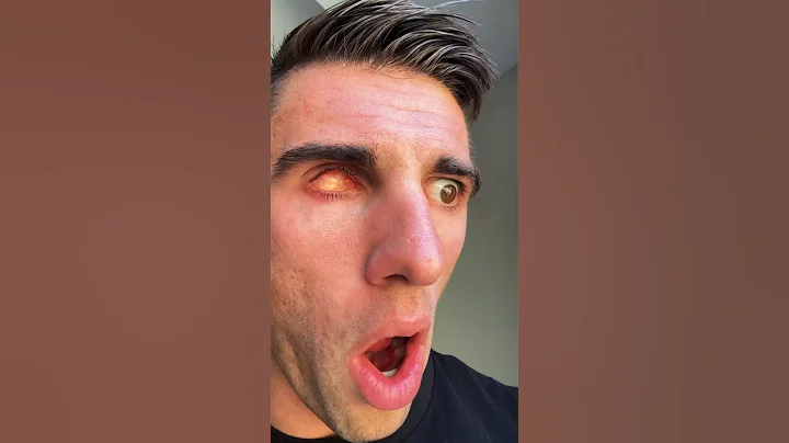 MY DIAMOND EYEBALL 😮