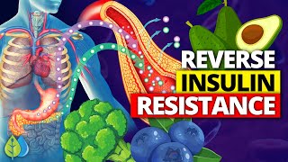 ❣️Top 13 Foods to Reverse Insulin Resistance