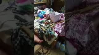 داء الفيل يحبس رجل في غرفته ٨سنوات ومناشدات لانهاء معاناته