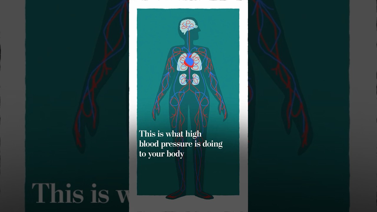 High blood pressure, explained