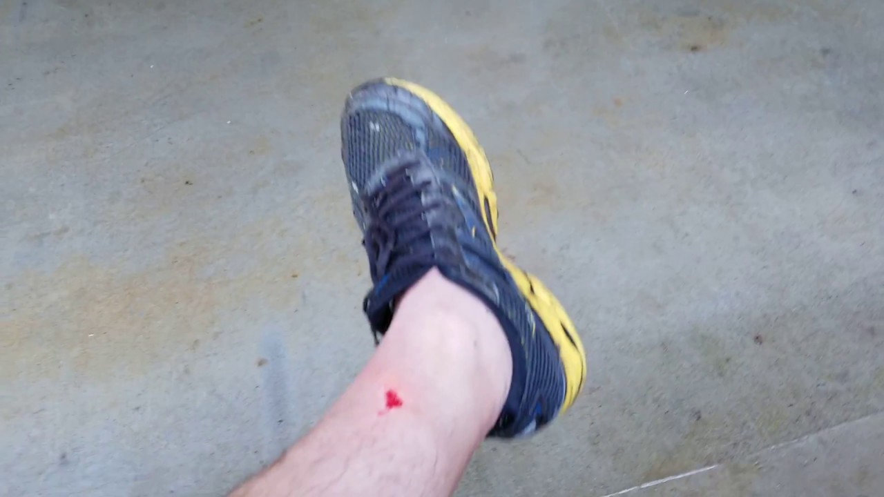 camera iphone 8 plus apk Cut leg with pressure washer be careful