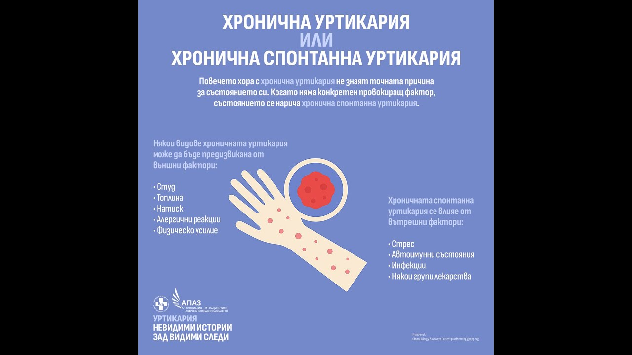 Уртикария - невидими истории зад видими следи