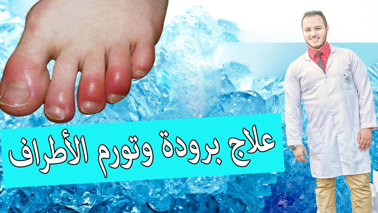 علاج برودة وتورم الأصابع في الشتاء