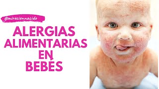 Alergias alimentarias del bebé