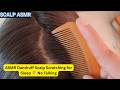 ASMR Dandruff Scalp Scratching for Sleep 😴 | No Talking #63 @OceansASMR