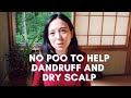 No Poo Method helped my Dandruff, Dry Scalp | Water wash Only | Asian Mixed Hair