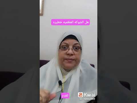 هل الشوكه العظميه خطيرة
